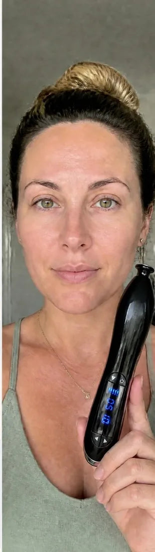 Danielle R., after Day 90: persistent redness