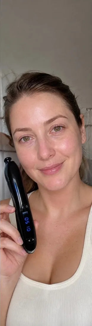 Hayley M., after Day 60: reactive redness